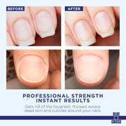 Blue Cross Cuticle Remover