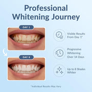 Teeth Whitening Strips
