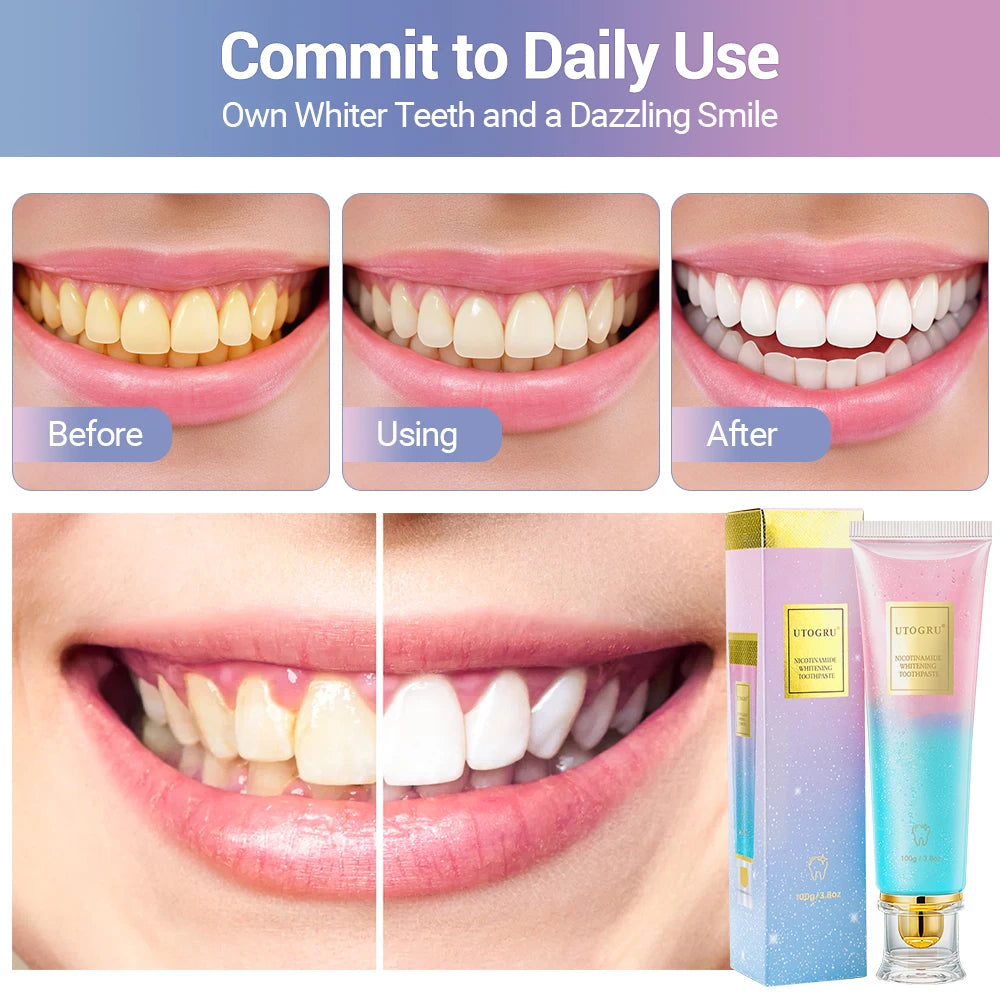 100g Niacinamide Whitening Toothpaste Refreshing Clean Teeth For Men And Women Fresh Breath Toothpaste To Remove Tooth Stains