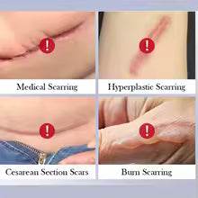 Scar Repair Cream