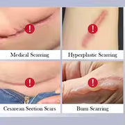 Scar Repair Cream