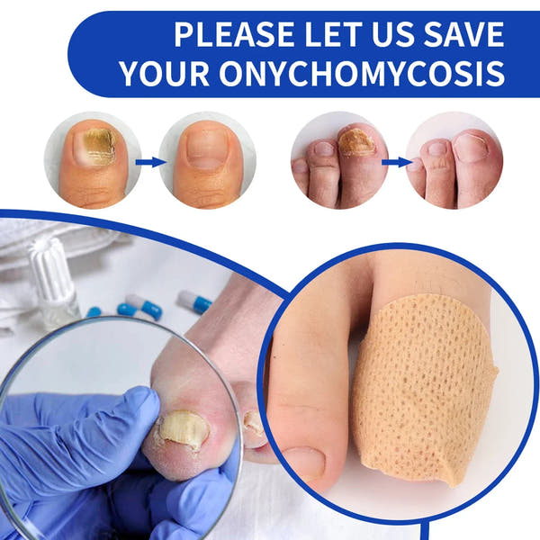 Breathable Toe Protection Patches